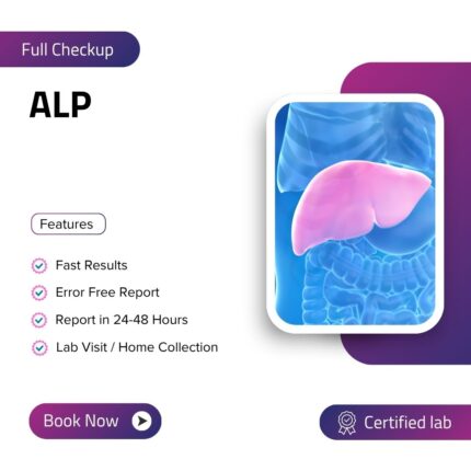 ALP (Alkaline Phosphatase)