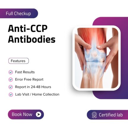 Anti-CCP Antibodies