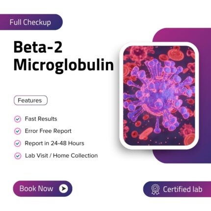 Beta-2 Microglobulin