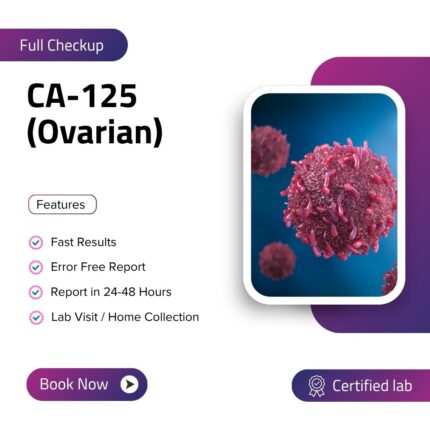 Cancer Antigen 125(Ovarian)