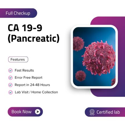 Carbohydrate Antigen 19-9(Pancreatic)