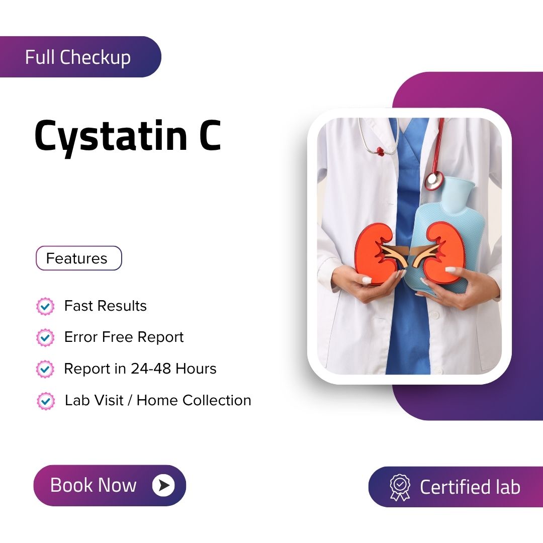 Care Test - Cystatin C