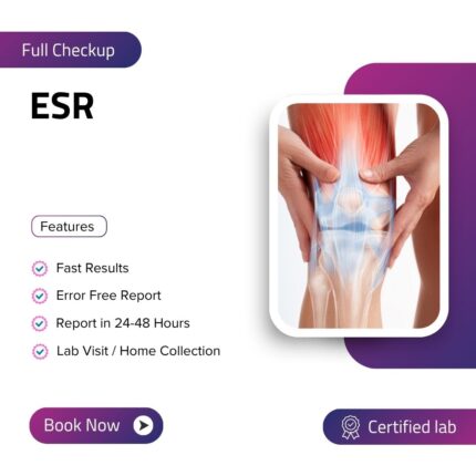 ESR (Erythrocyte Sedimentation Rate)