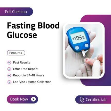 Fasting Blood Glucose