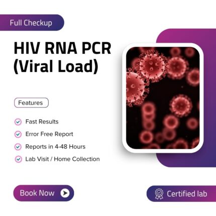 HIV RNA PCR (Viral Load)