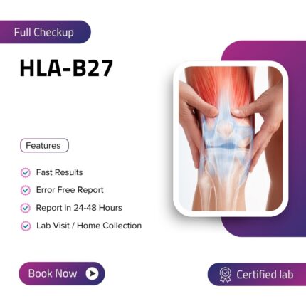 HLA-B27