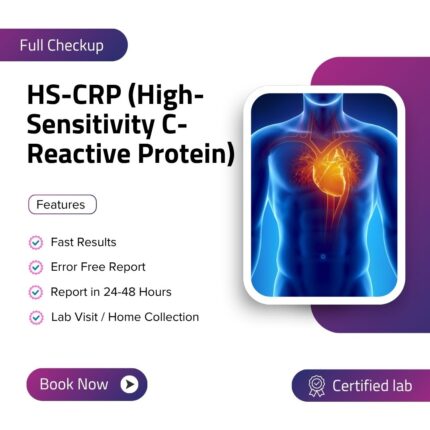 HS-CRP (High-Sensitivity C-Reactive Protein)