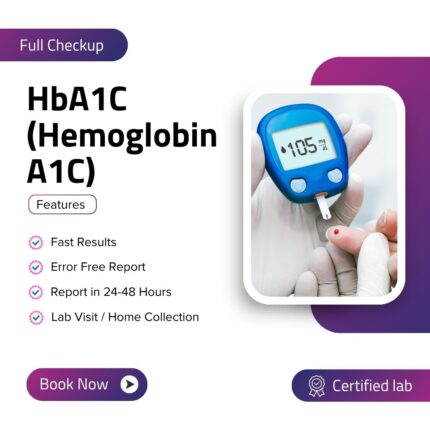 HbA1C (Hemoglobin A1C)