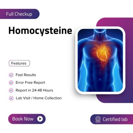 Homocysteine