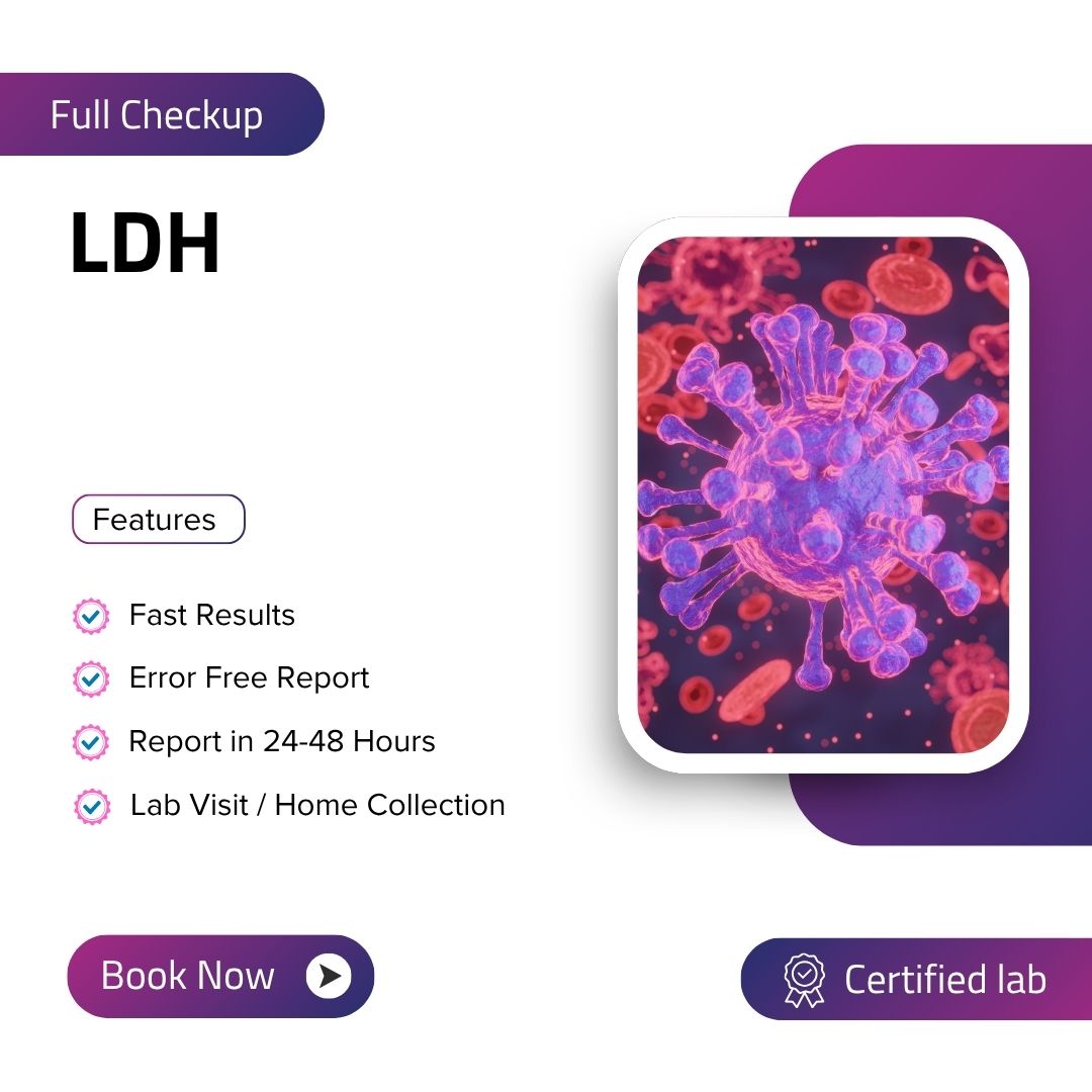 Care Test - LDH