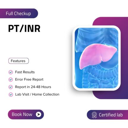 PT/INR