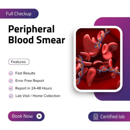 Peripheral Blood Smear