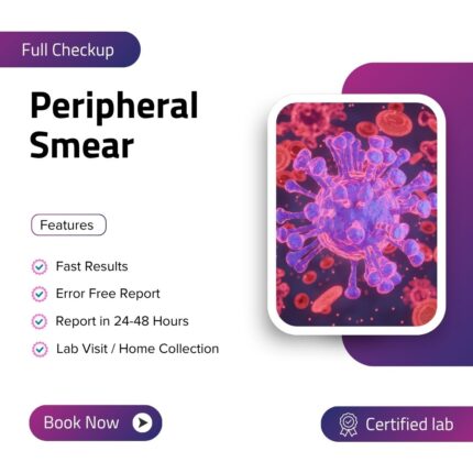 Peripheral Smear