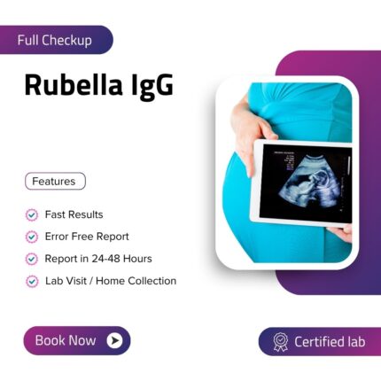 Rubella IgG