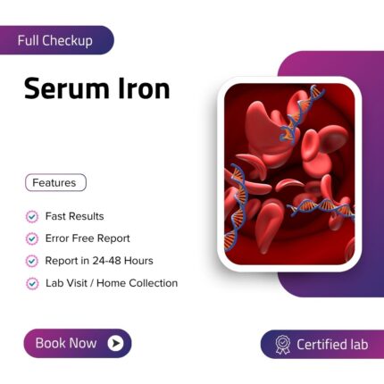 Serum Iron