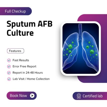 Sputum AFB Culture