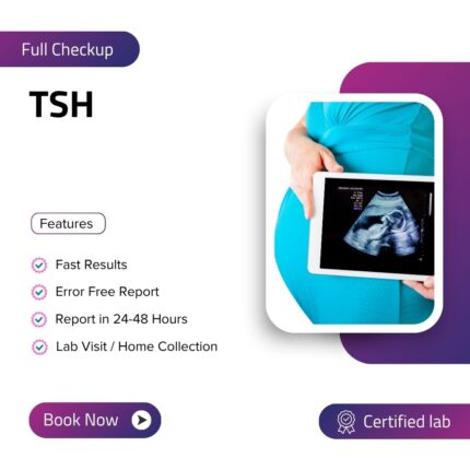 Thyroid-Stimulating Hormone (TSH)