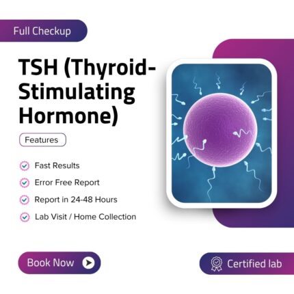TSH (Thyroid-Stimulating Hormone)