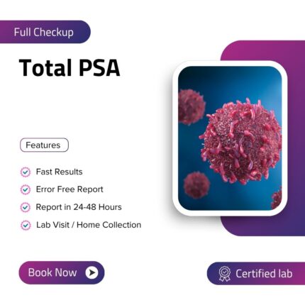 Total PSA (Prostate-Specific Antigen)