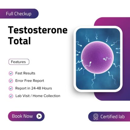 Testosterone Total
