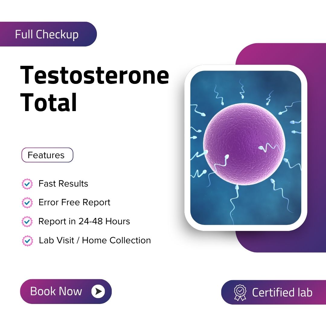 Care Test - Testosterone Total