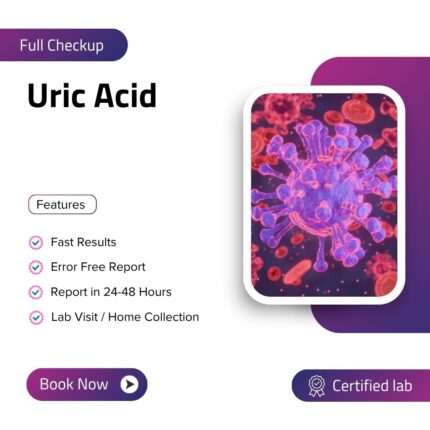 Uric Acid