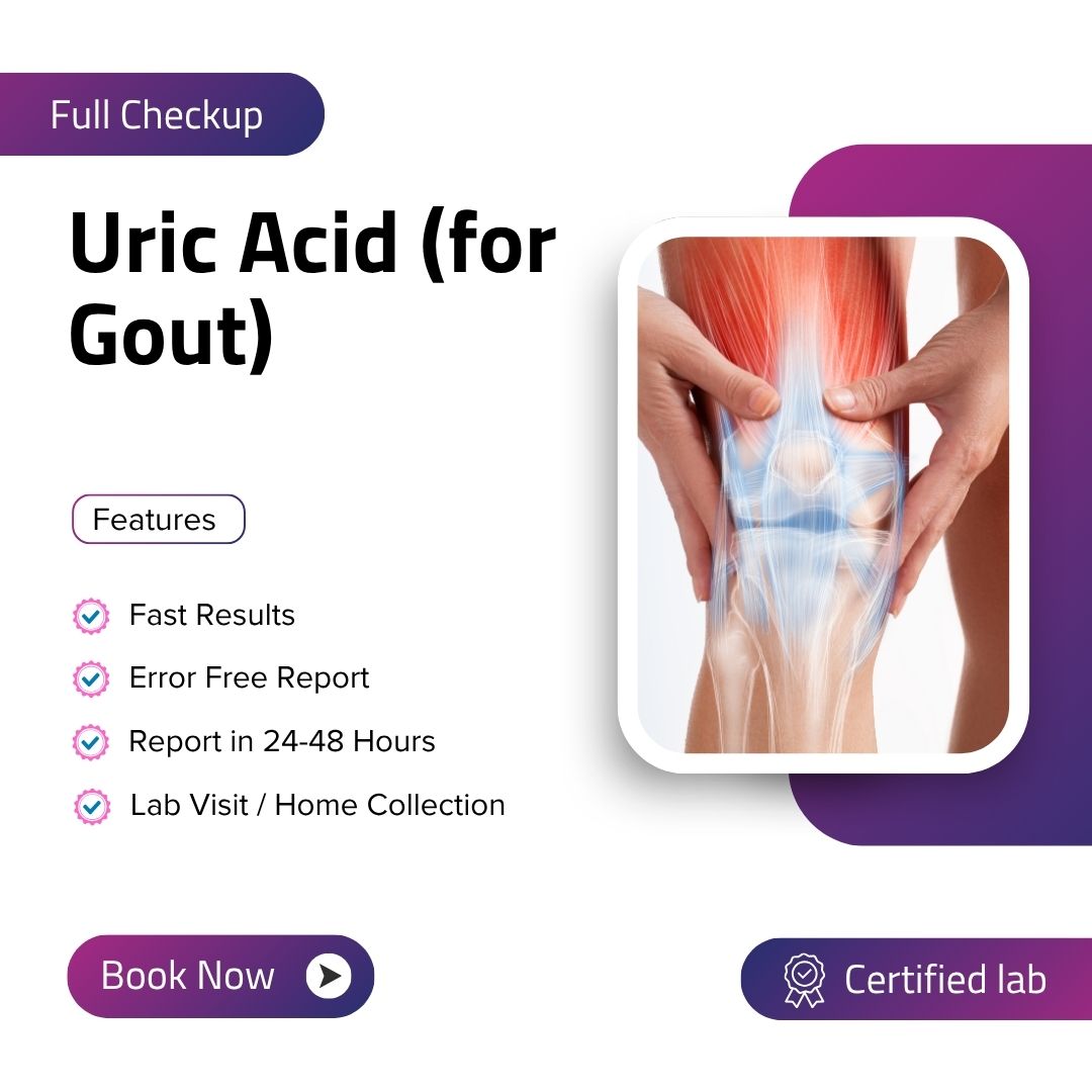 Care Test - Uric Acid (for Gout)