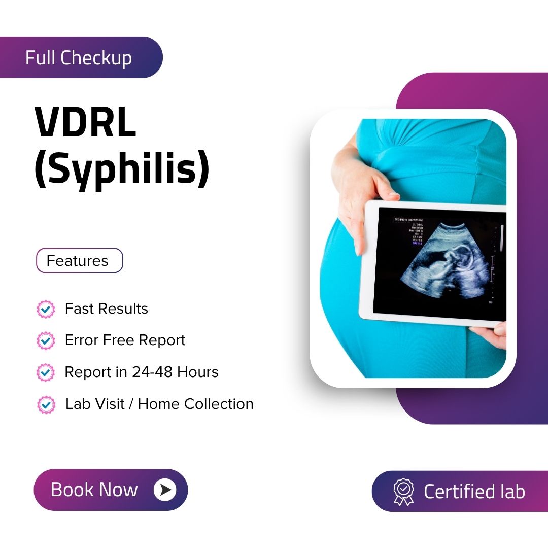 Care Test - VDRL (Syphilis)