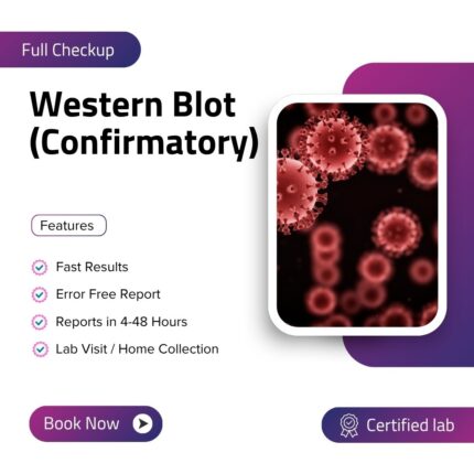 Western Blot (Confirmatory)