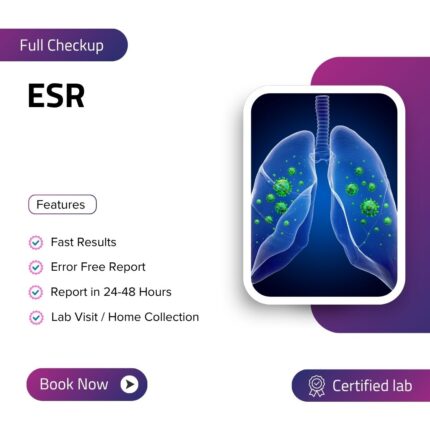 Erythrocyte Sedimentation Rate (ESR)
