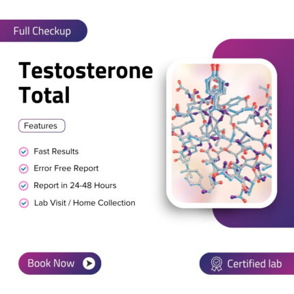Testosterone Total