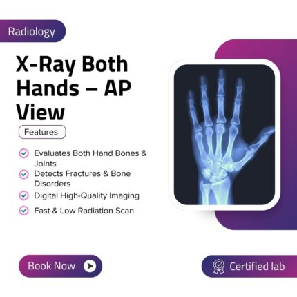 X-Ray Both Hands – AP View