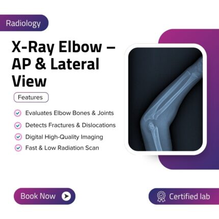X-Ray Elbow – AP & Lateral View