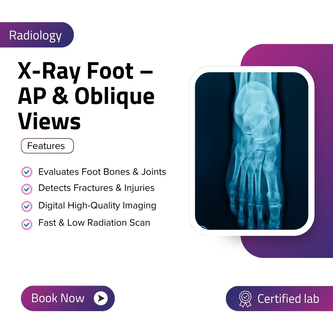 X-Ray Foot – AP & Oblique Views