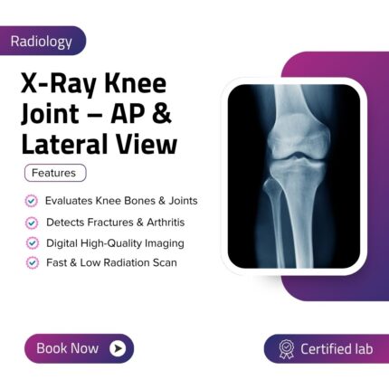 X-Ray Knee Joint – AP & Lateral View