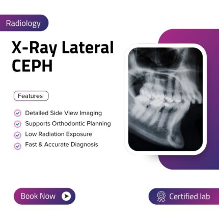X-Ray Lateral CEPH