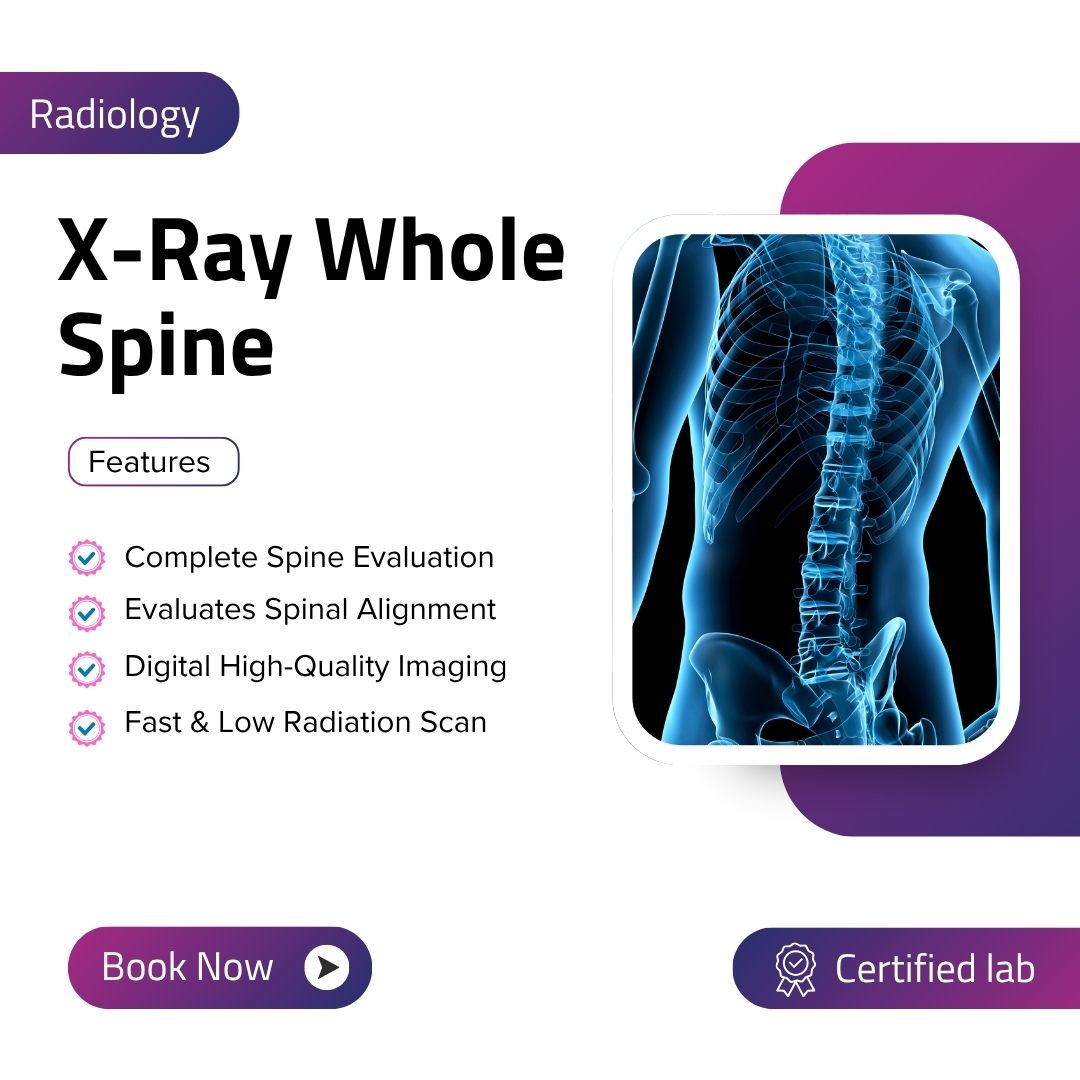 X-Ray Whole Spine