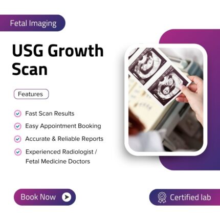 USG Growth Scan