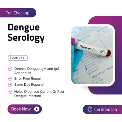 Dengue Serology