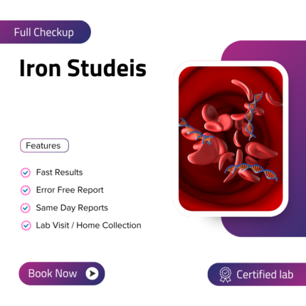 Iron Studies