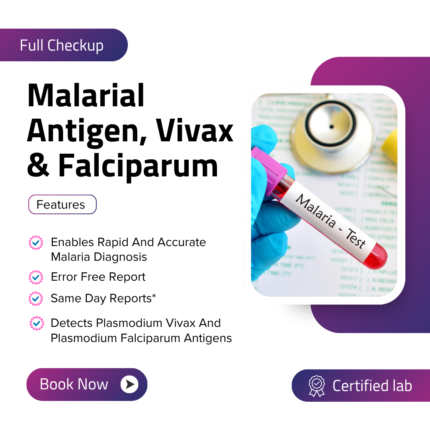 Malarial Antigen, Vivax & Falciparum