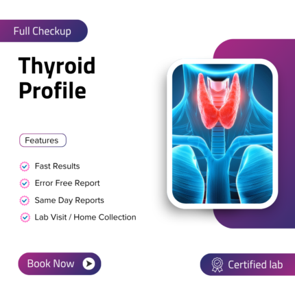 Thyroid Profile