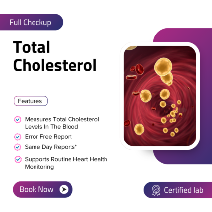 Total Cholesterol