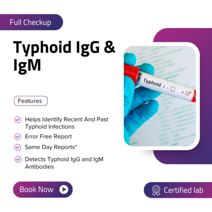 Typhoid IgG & IgM
