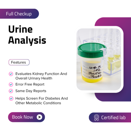 Urine Analysis