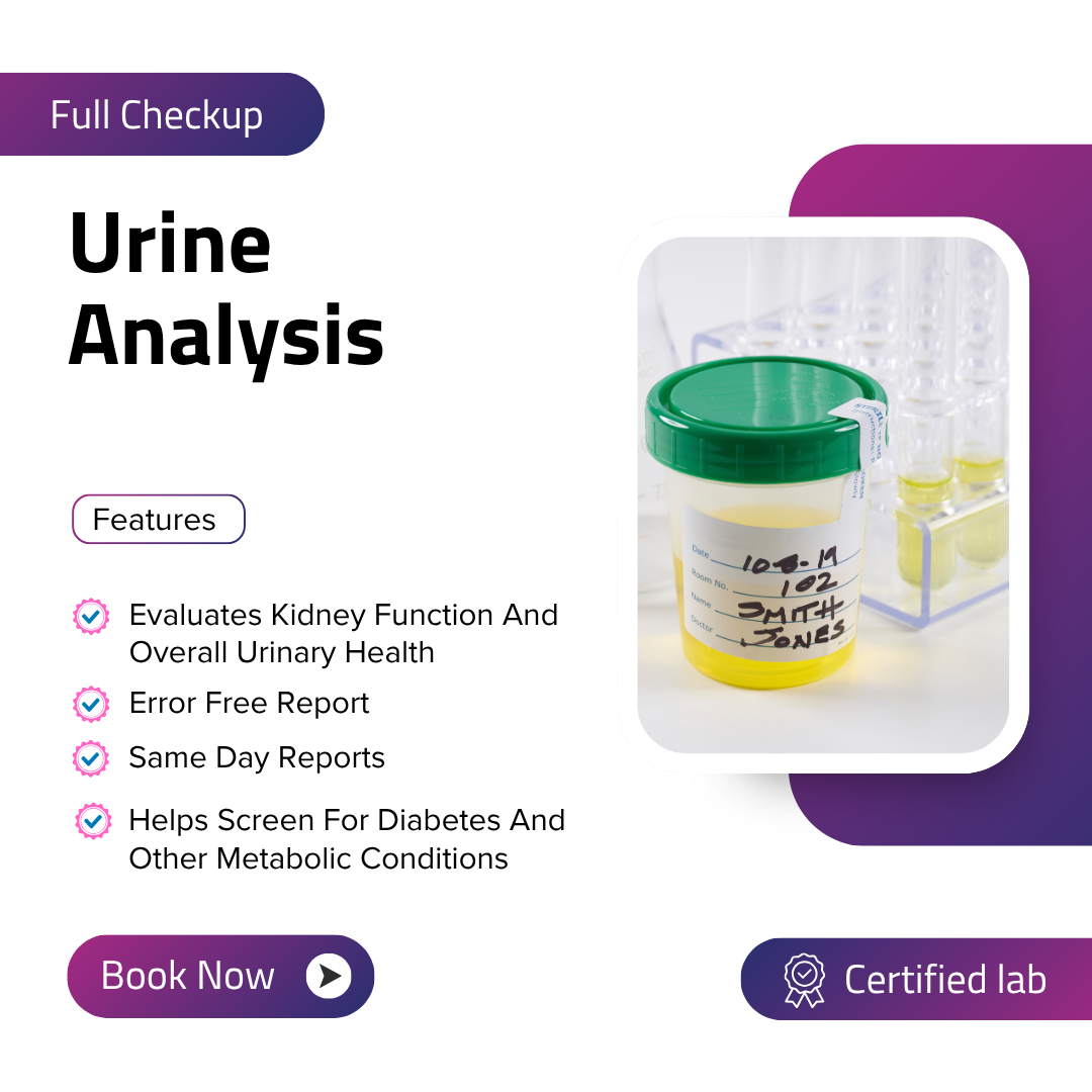 Urine Analysis