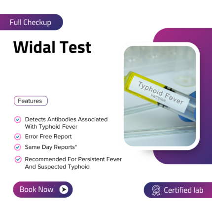Widal Test